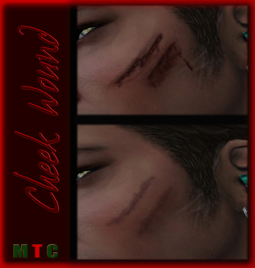 :: Jk Wound + Scar  :: Cheek