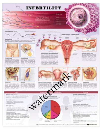 SWE Poster - Infertility