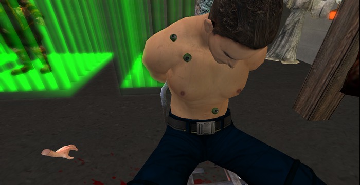 F.G.M.N/ Infected man
