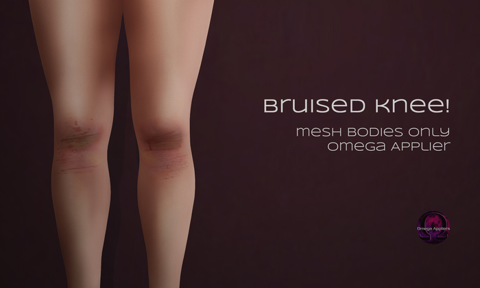 .:cheeky:. bruised Knee! Omega Apllier