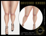 Bruisedkneesad