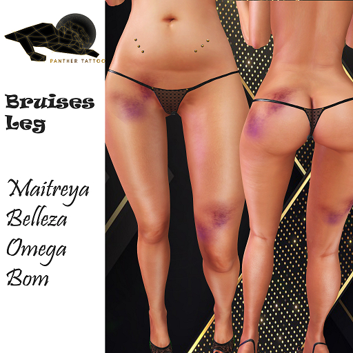 Bruises Leg