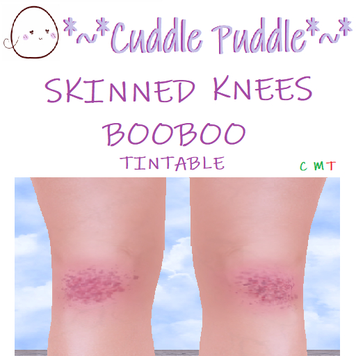 *~*CUDDLE PUDDLE*~* SKINNED KNEES BOOBOOS