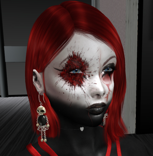 Blood stain on the eye