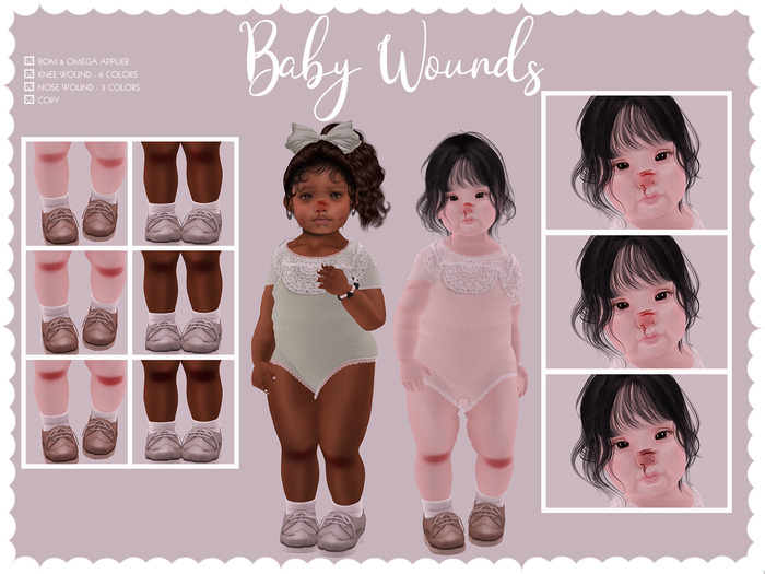 {Little Tots} Baby wounds
