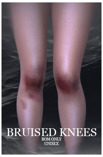 Naps - Bruised knees