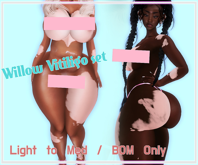 .HATION. Willow Body Vitiligo