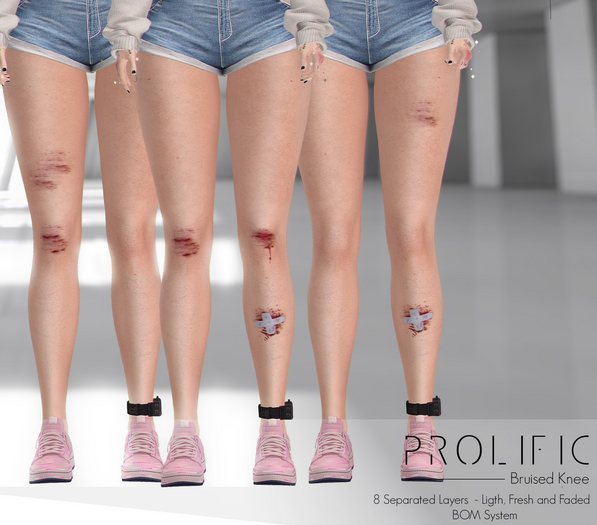 [Prolific] Bruised Knee