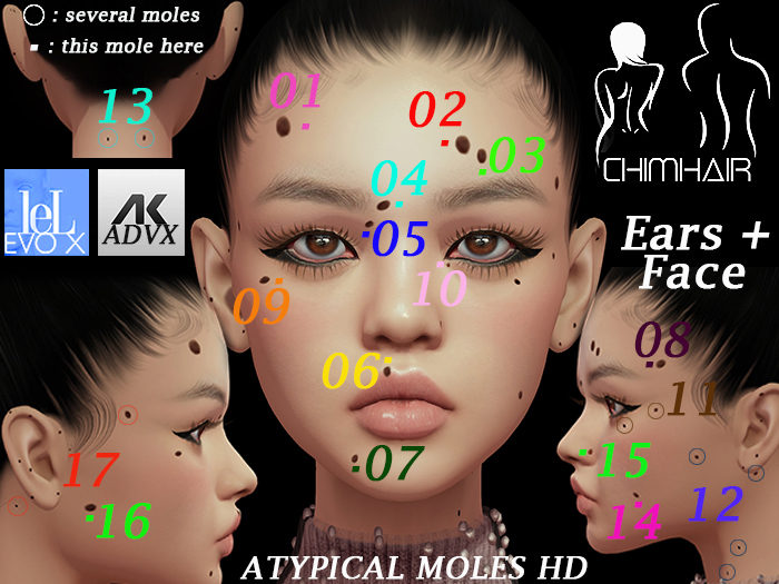 .CHIMHAIR."MEGA FATPACK Unisex - ATYPICAL BIG MOLES - BEAUTY MARKS HD + EARS + EARS MIRROR" [Lel EvoX] [[AK ADVX] Set145