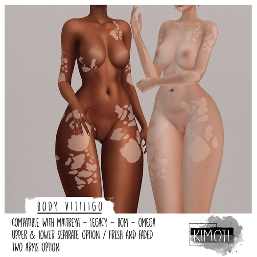 ~Kimoti~ \\ Body Vitiligo