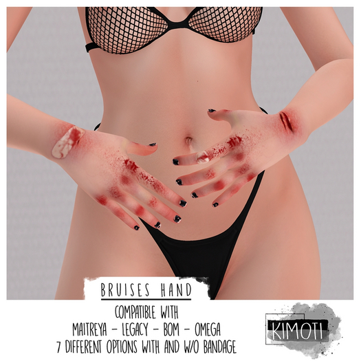 ~Kimoti~ \\ Bruises Hand
