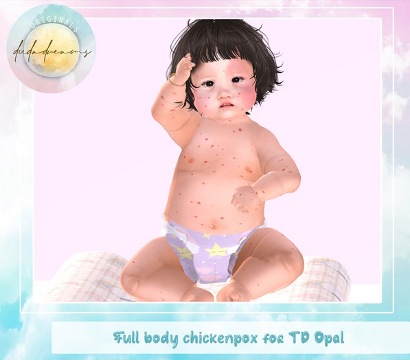 DudaDreams Originals <3 - Chickenpox for Toddleedoo