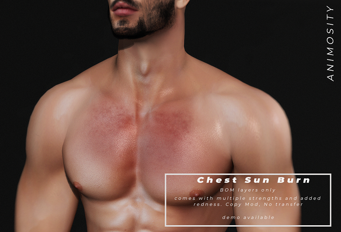 Animosity - Chest Sun Burn - BOM Only