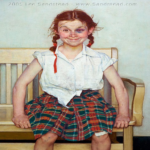 Young lady with a shiner
