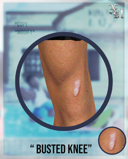 X// Busted Knee