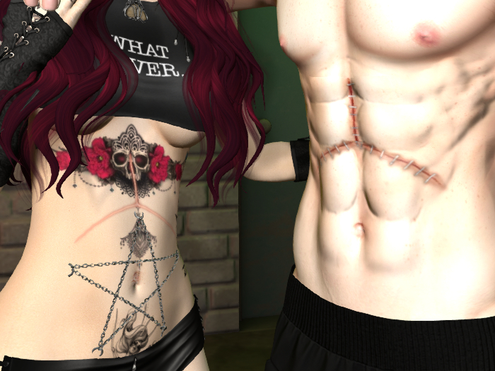 ~TDP~  Liver Transplant Set