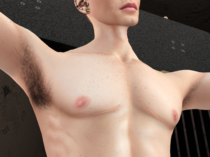~TDP~ Top Surgery Scars