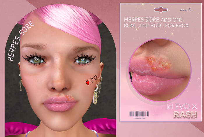 RASH herpes sores- GIFT 