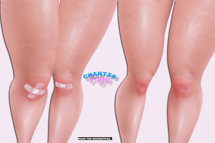 ::Injured knees :: 