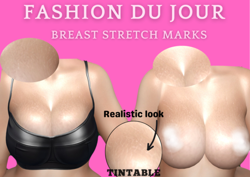 Breast Stretch Marks