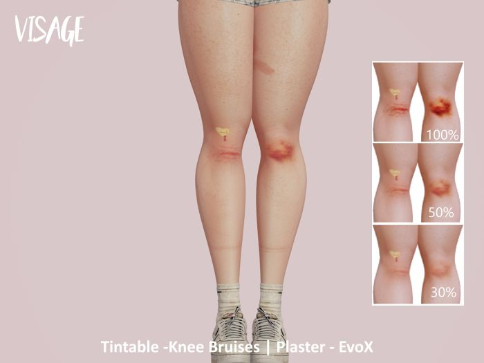 Visage - Bruised Knee