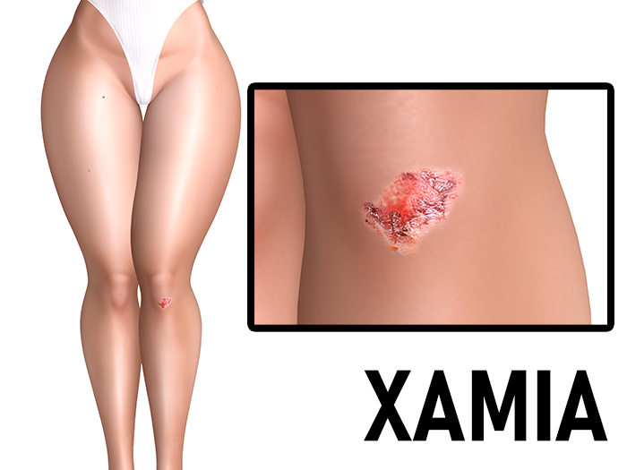 XAMIA - Knee Scrape - eBody Reborn