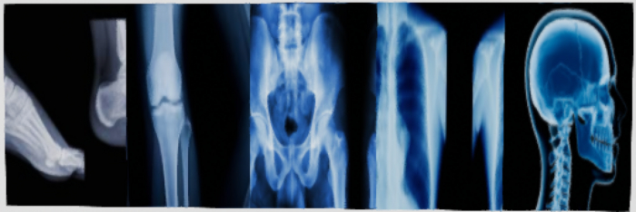 X-RAY 5 panel mesh (boxed) 