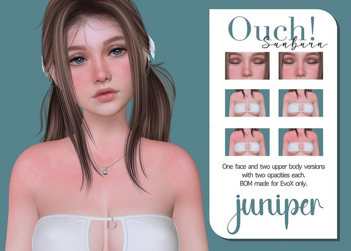 .:. Juniper .:. Ouch Sunburn