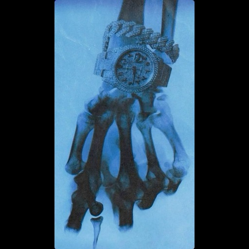 Skelecton Watch