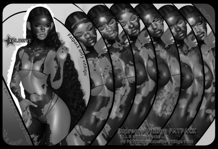XCLUSIVE Supreme Vitiligo FATPACK DEMO