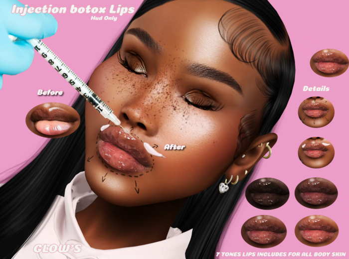 GLOW'S-INJECTION BOTOX LIPS EVO X