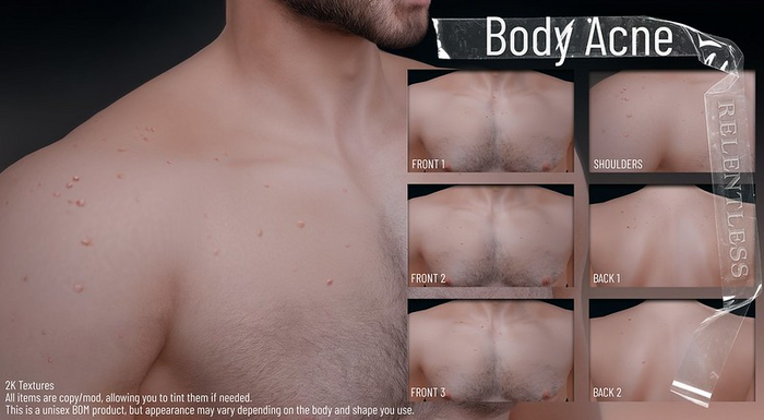 RELENTLESS Body Acne