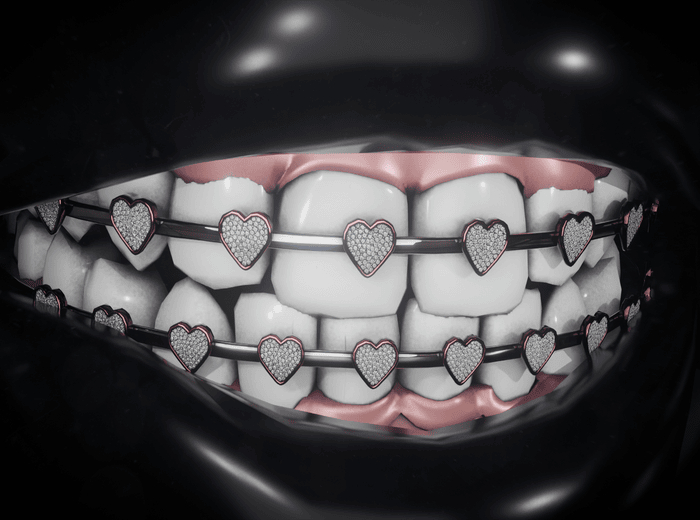 Diamond Heart Braces