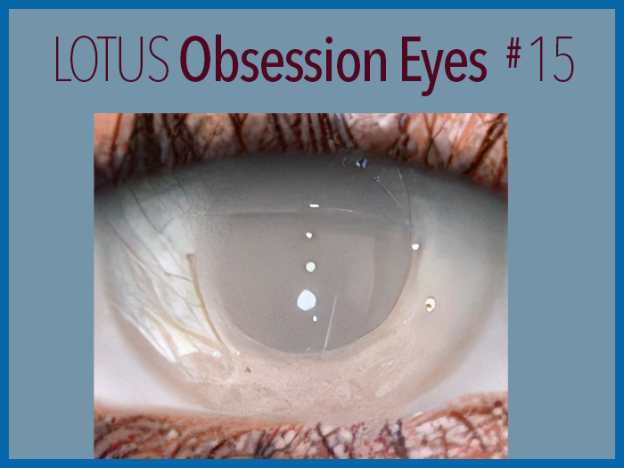 LOTUS. Obsession Eyes 15 MESH