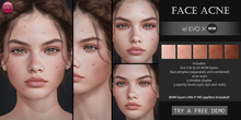 Izzie's - Face Acne (Evo X & regular BOM)