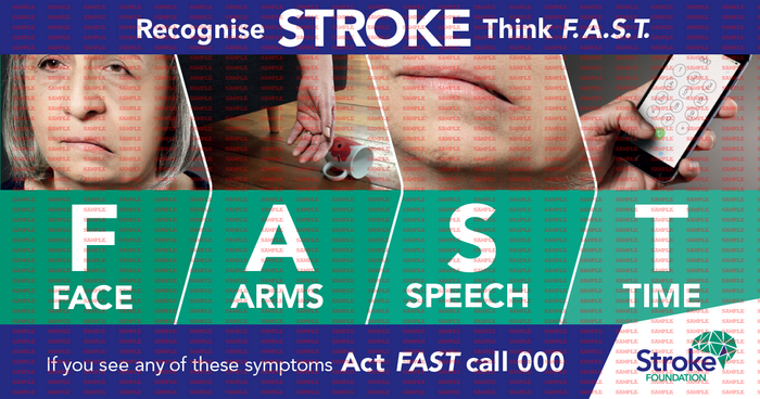 Medical Poster - F.A.S.T.