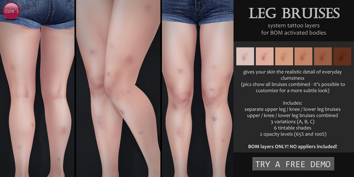 Izzie's - Leg Bruises