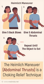 Medical Poster - Heimlich