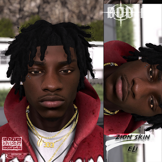 B - Zion Skin. (Eli)
