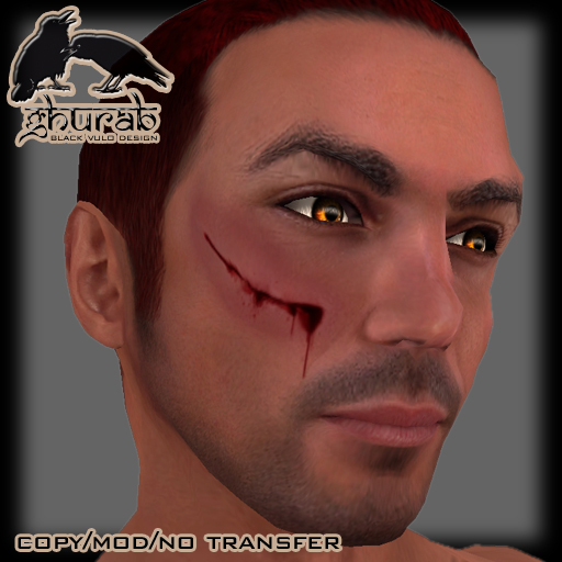 Cut in right cheek - Wound