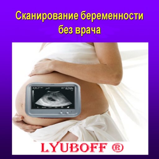 "Scan Pregnancy Animated" HUD "LYUBOFF" (Сканирование беременности для HUD "LYUBOFF")