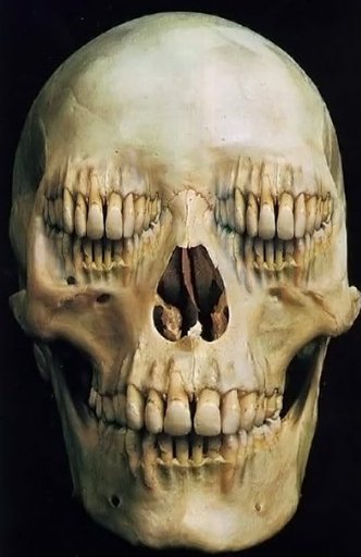 Skull Teeth Poster