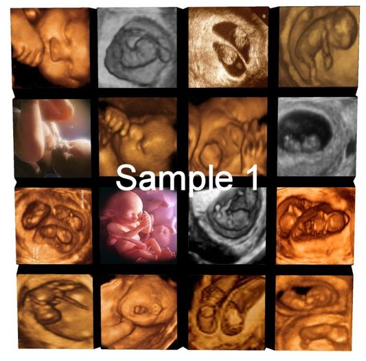 MC_74 FP Ultrasound pictures