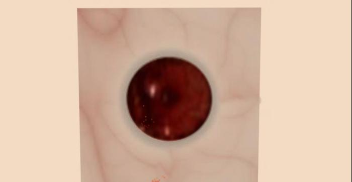 Devon Red Devil eyes